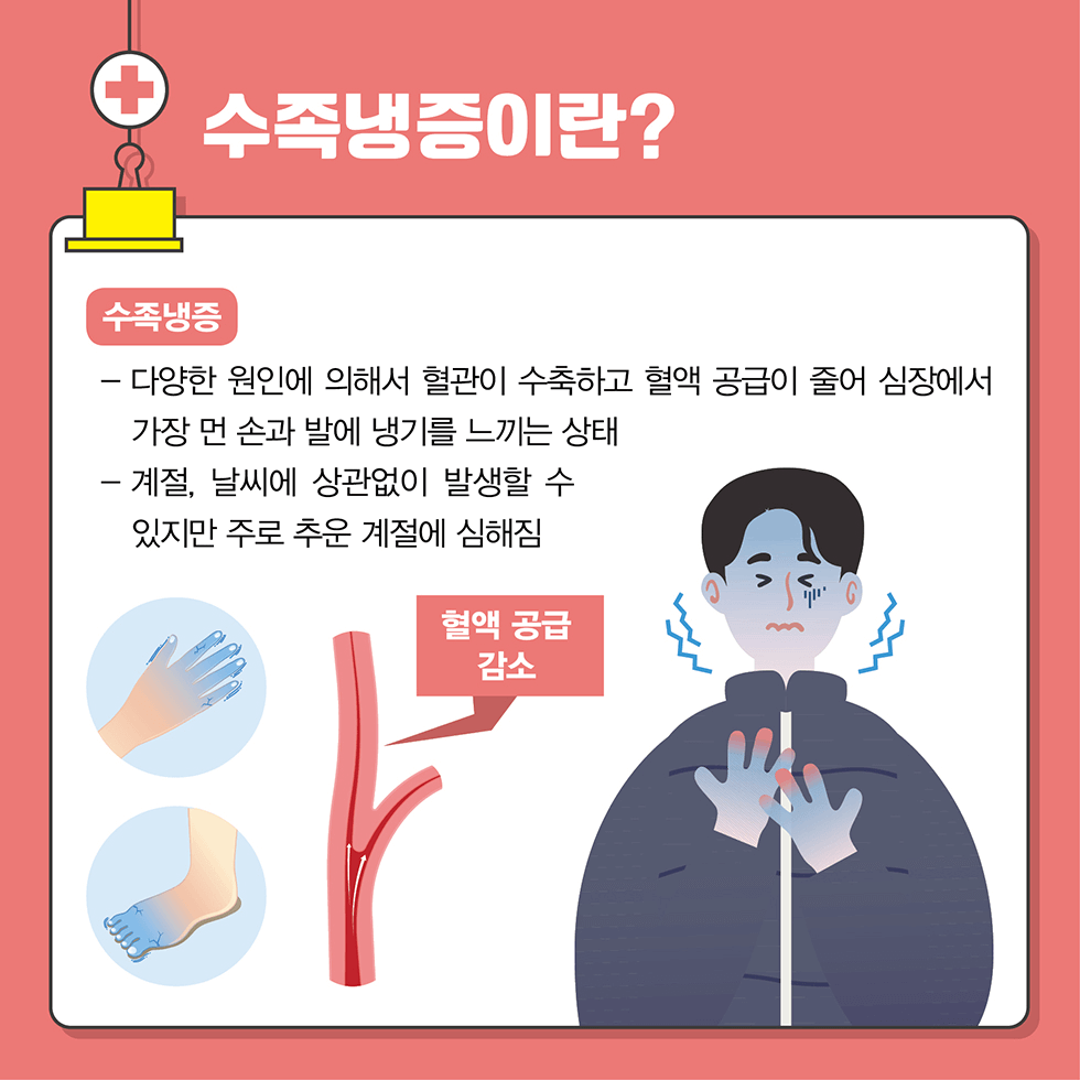 수족냉증이란? (출처 : 가톨릭대학교 가톨릭중앙의료원)