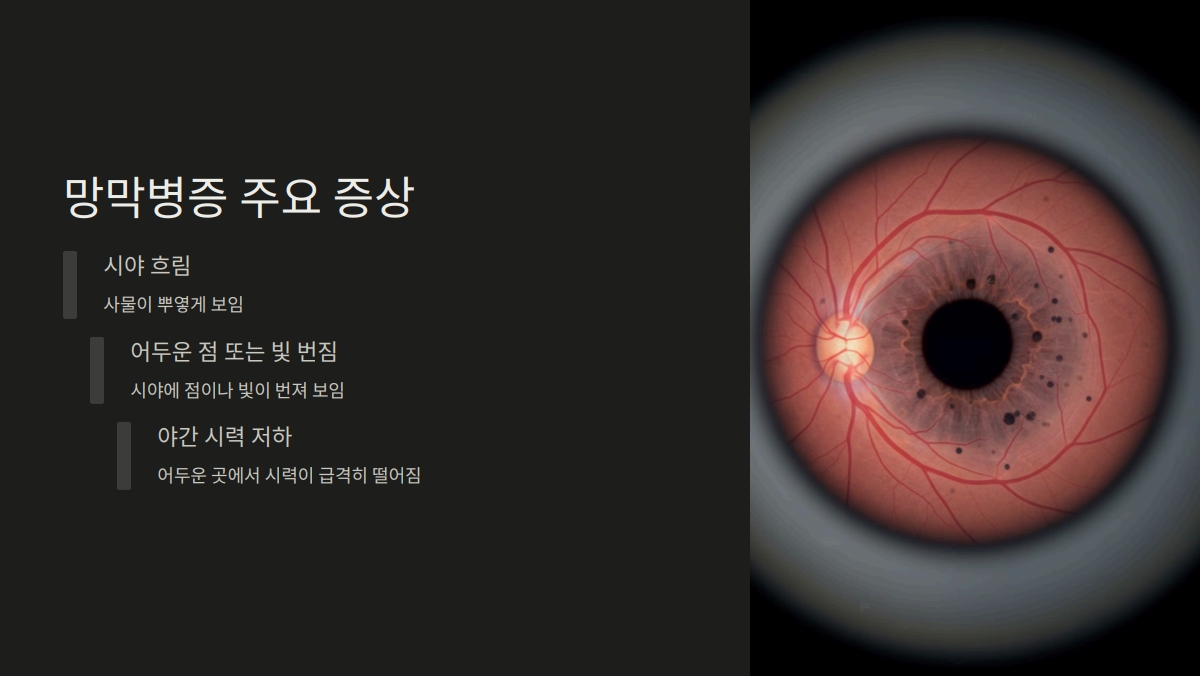 제2형 당뇨병 합병증