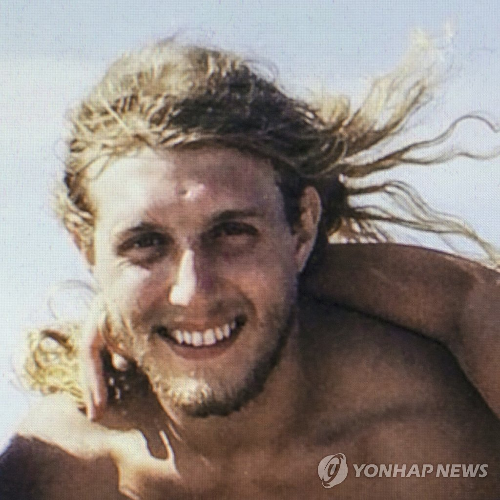 "이마에 입 맞춰도 될까요?" 죽은 외아들의 얼굴을 이식받은 남성을 보고 하염없이 눈물 흘린 어머니