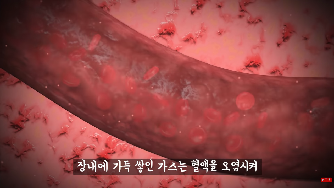  방귀를 참으면 안되는 이유, 잘 나오는 자세