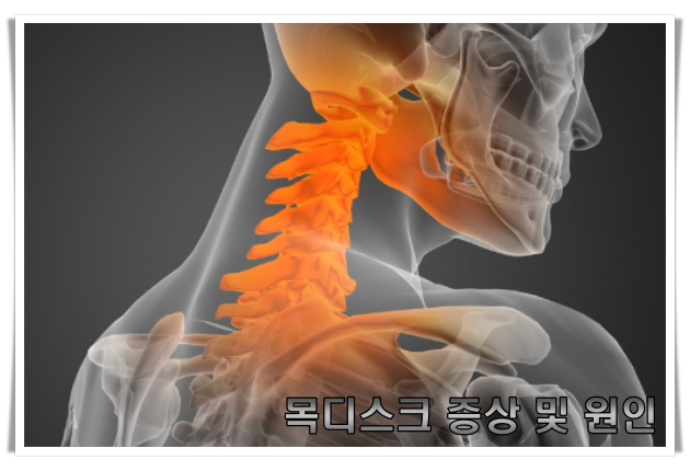 목디스크 증상