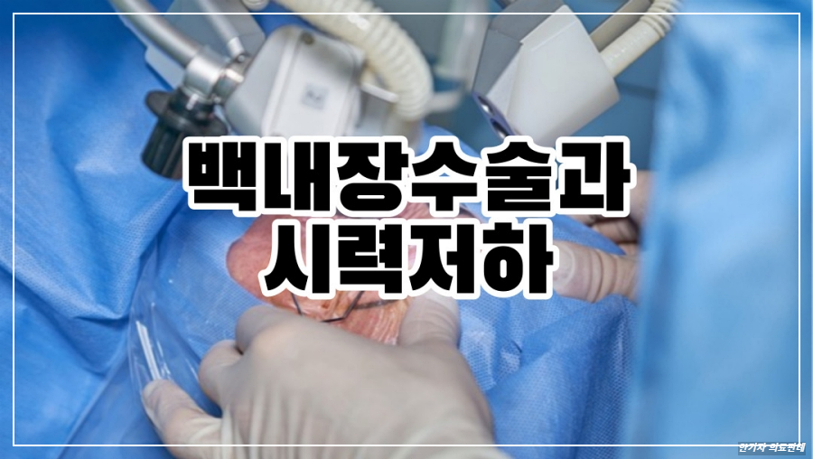 백내장 수술 사진