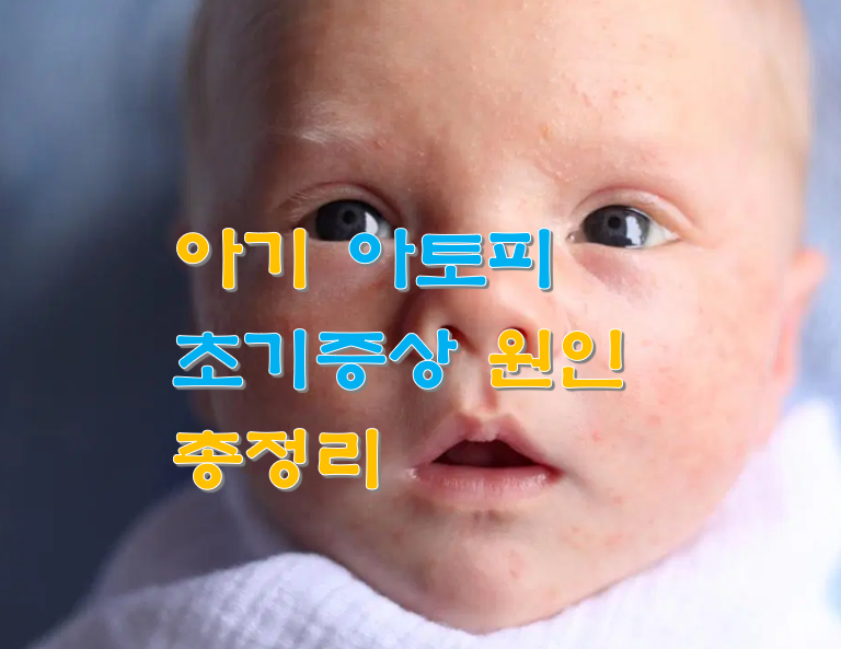  아기 아토피 초기증상 원인 총정리
