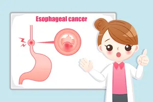 속쓰림-원인