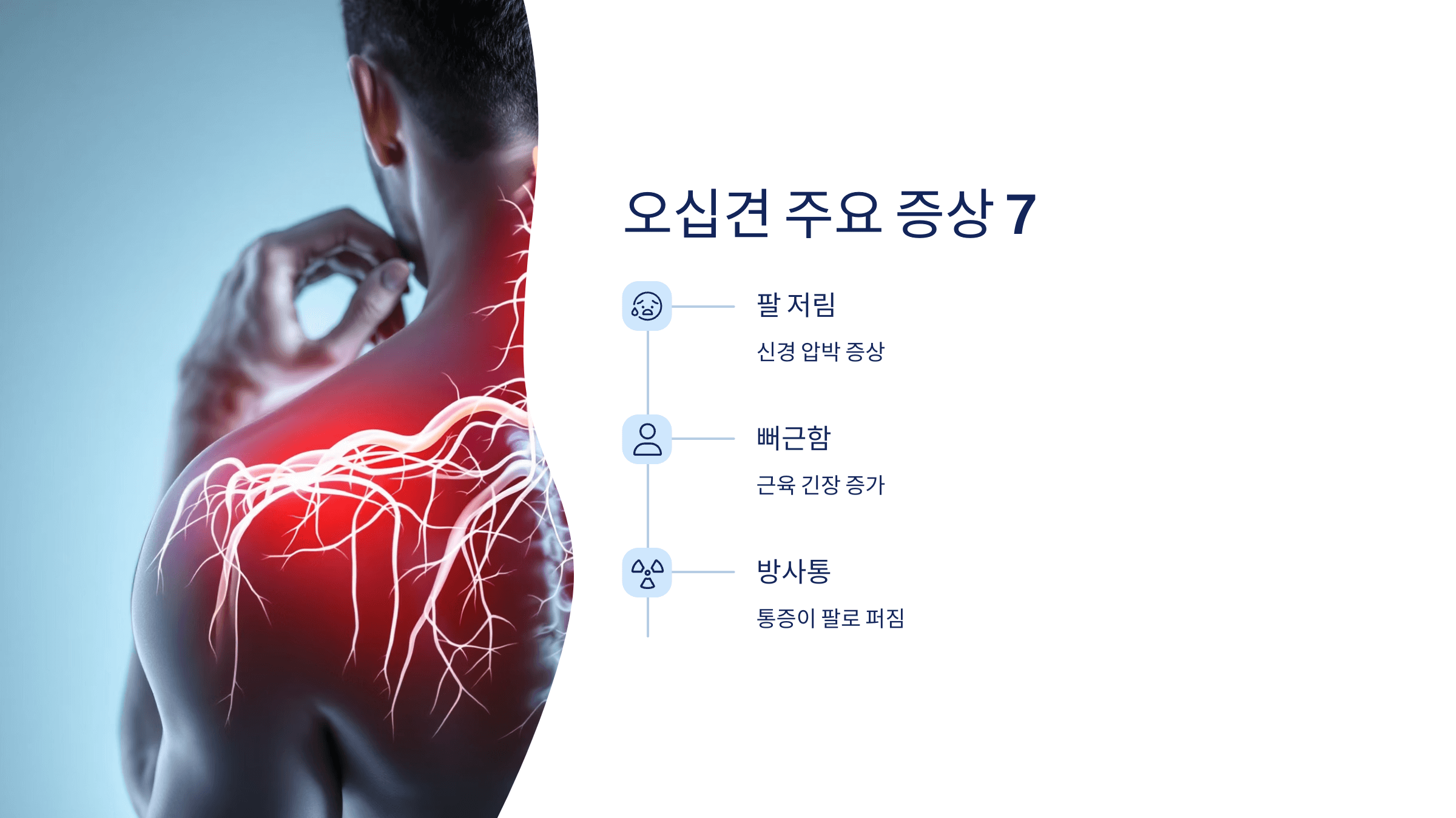 오십견 사진입니다.