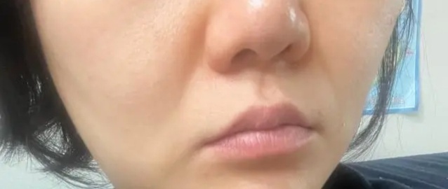 링클백 후기