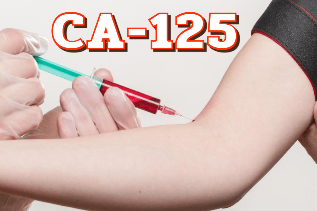 CA-125