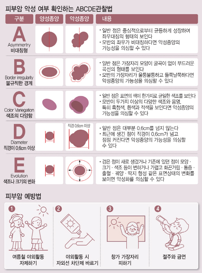 발톱-흑색종-초기-증상-치료-사진