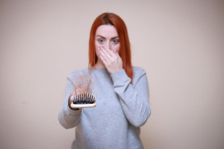 여성 탈모 사진 (picture of woman hair loss)