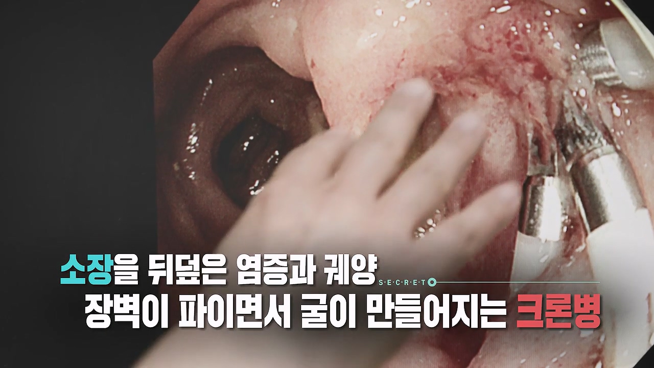 생로병사의 비밀.E884.230921p-NEXT.mp4_20230921_202752.940.jpg