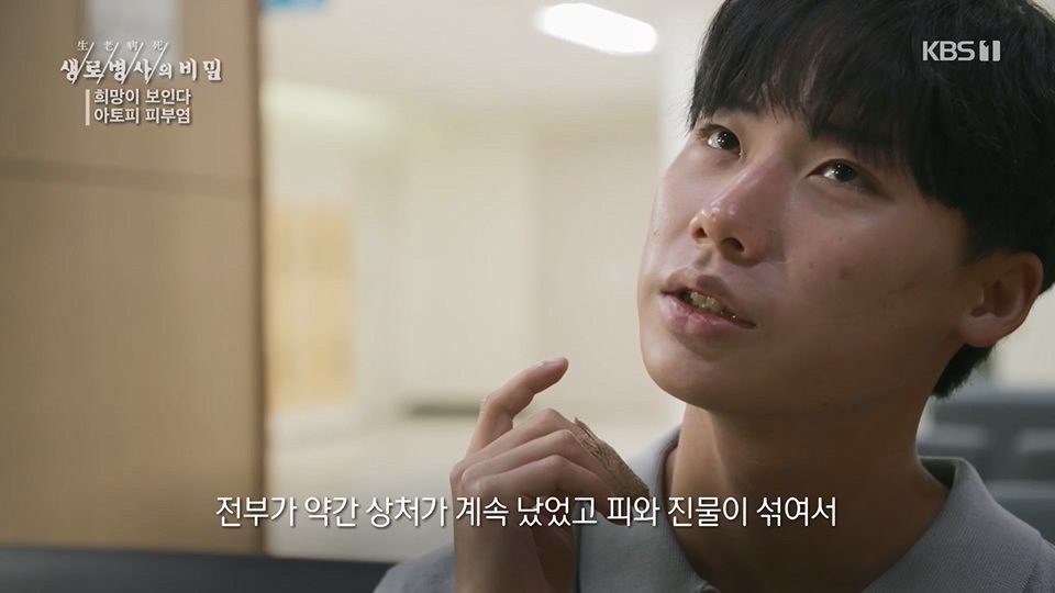 생로병사의 비밀.E872.230628p.H264-F1RST.mp4_20230707_214232.669.jpg