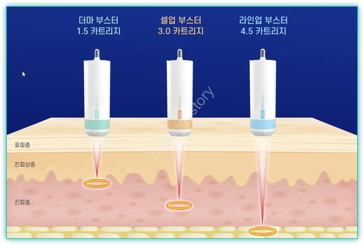 카트리지2