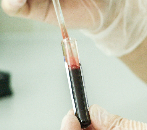 당뇨병의 초기 증상