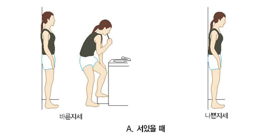 허리디스크 증세