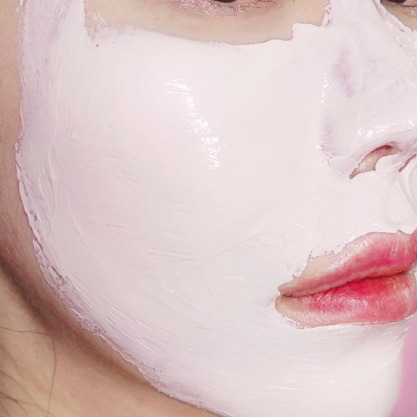 베리케어 이미지