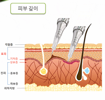 두피 문신'의 부작용이 탈모?? 두피 문신'의 부작용이 탈모??