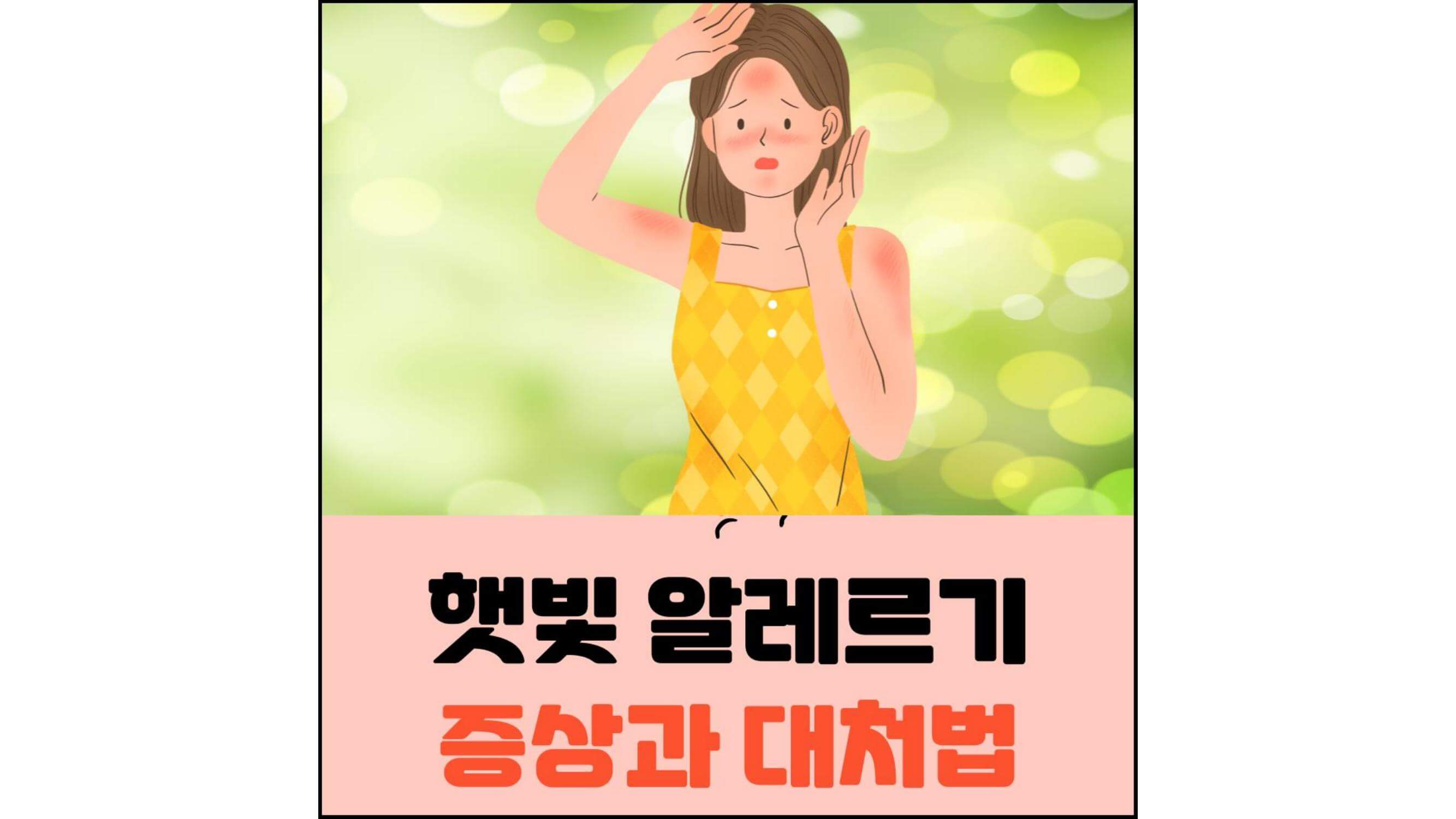 햇빛-알레르기-증상과-대처법-섬네일