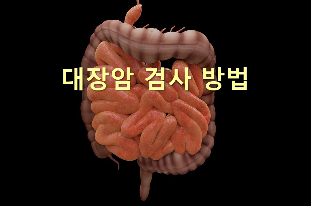  대장암 검사 방법으로 대장 내시경 검사와 대장 조영 검사