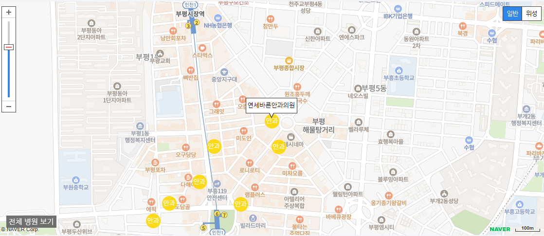 인천광역시 일요일 진료 안과 병원 연세바른안과의원
