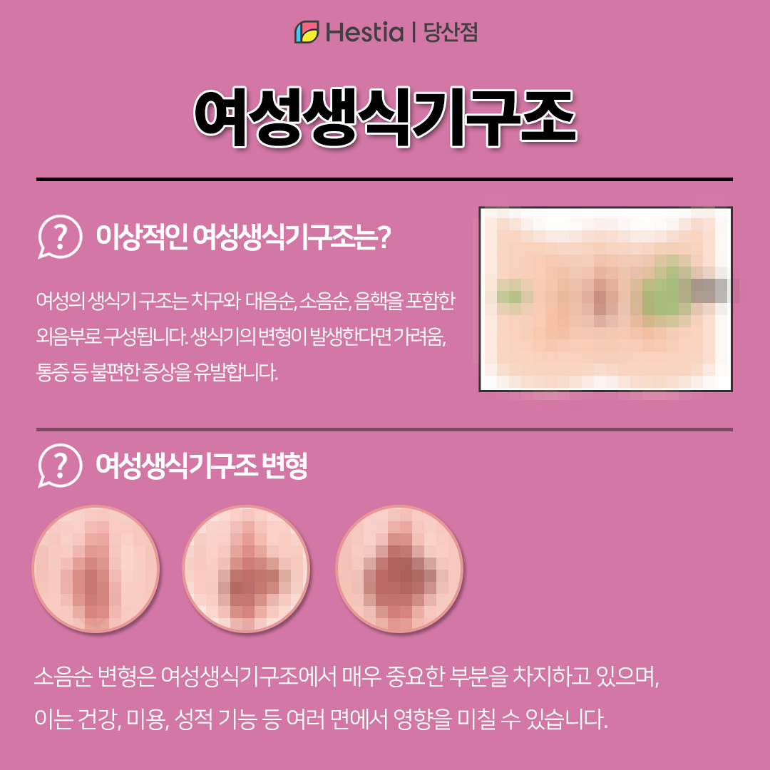 여성생식기구조가 궁금합니다!