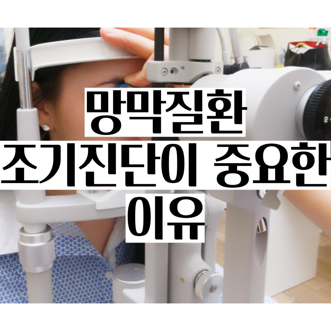 망막질환 실명 조기진단 안과 치료 주사