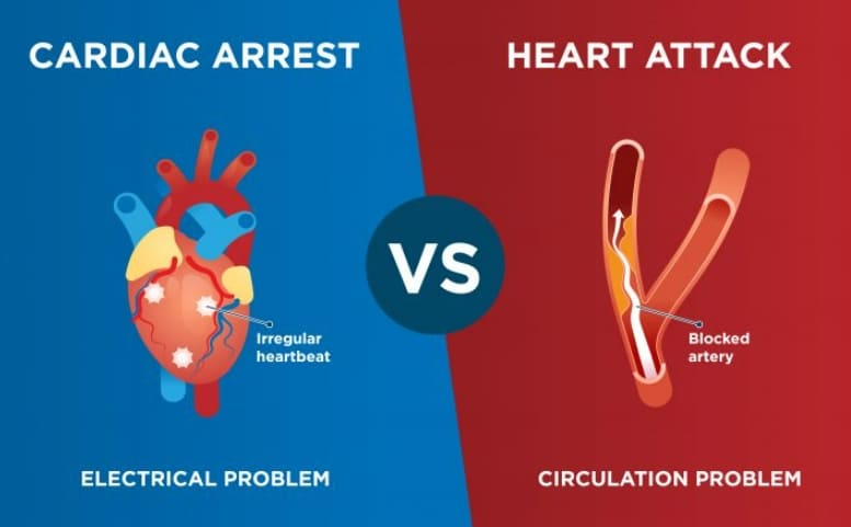  급사 원인 '급성 심장마비(Cardiac arrest)' 하루 전 증상: 남여 다르다 Before a cardiac arrest, men and women have different symptoms, study finds