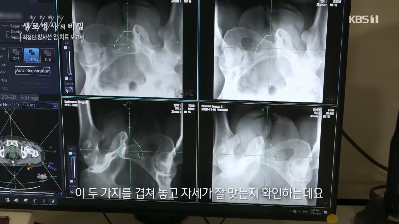 생로병사의 비밀.E896.240132p.H264-F1RST.mp4_20240202_195819.095.jpg