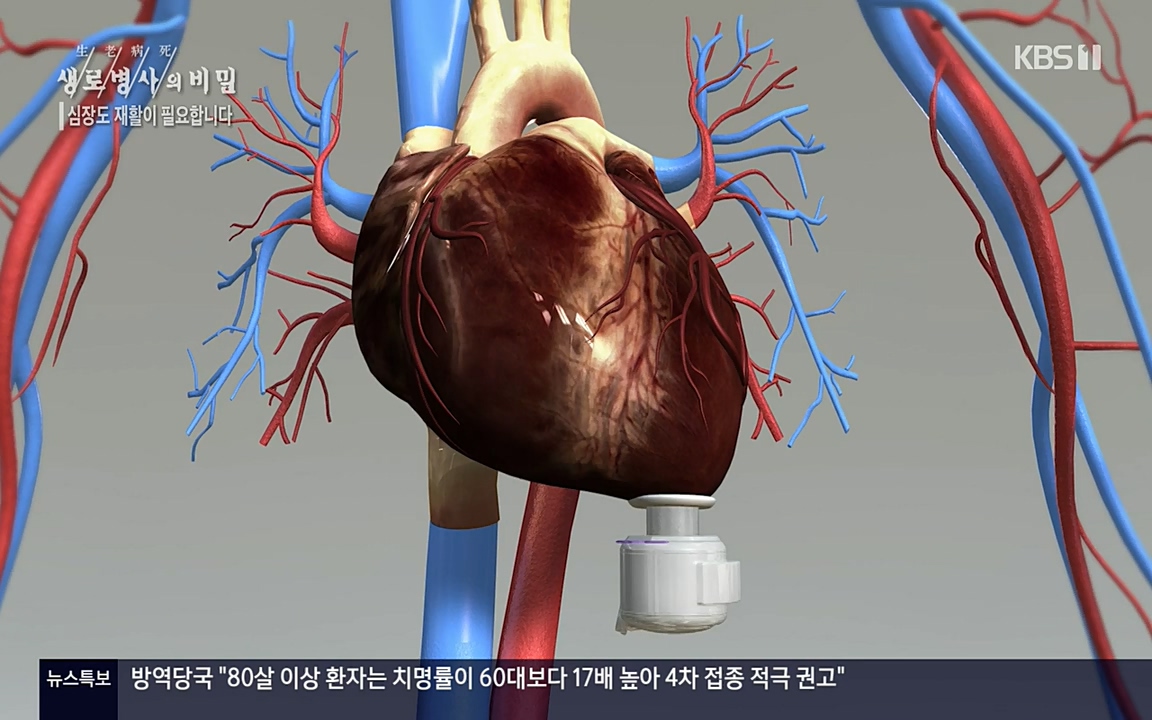 생로병사의 비밀.E820.220428p-NEXT.mp4_20220501_192745.697.jpg