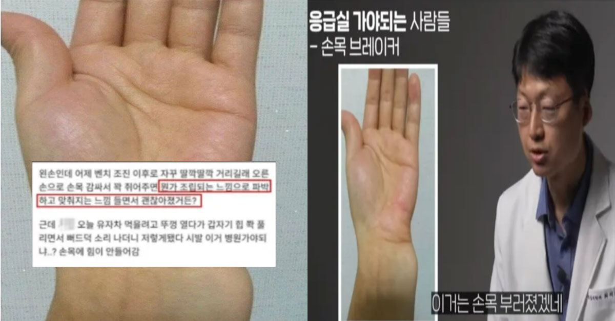  디시 손목 브레이커를 본 의사의 반응