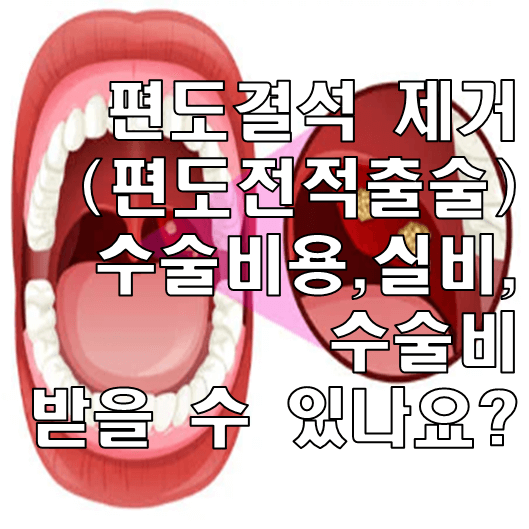 편도결석 썸네일