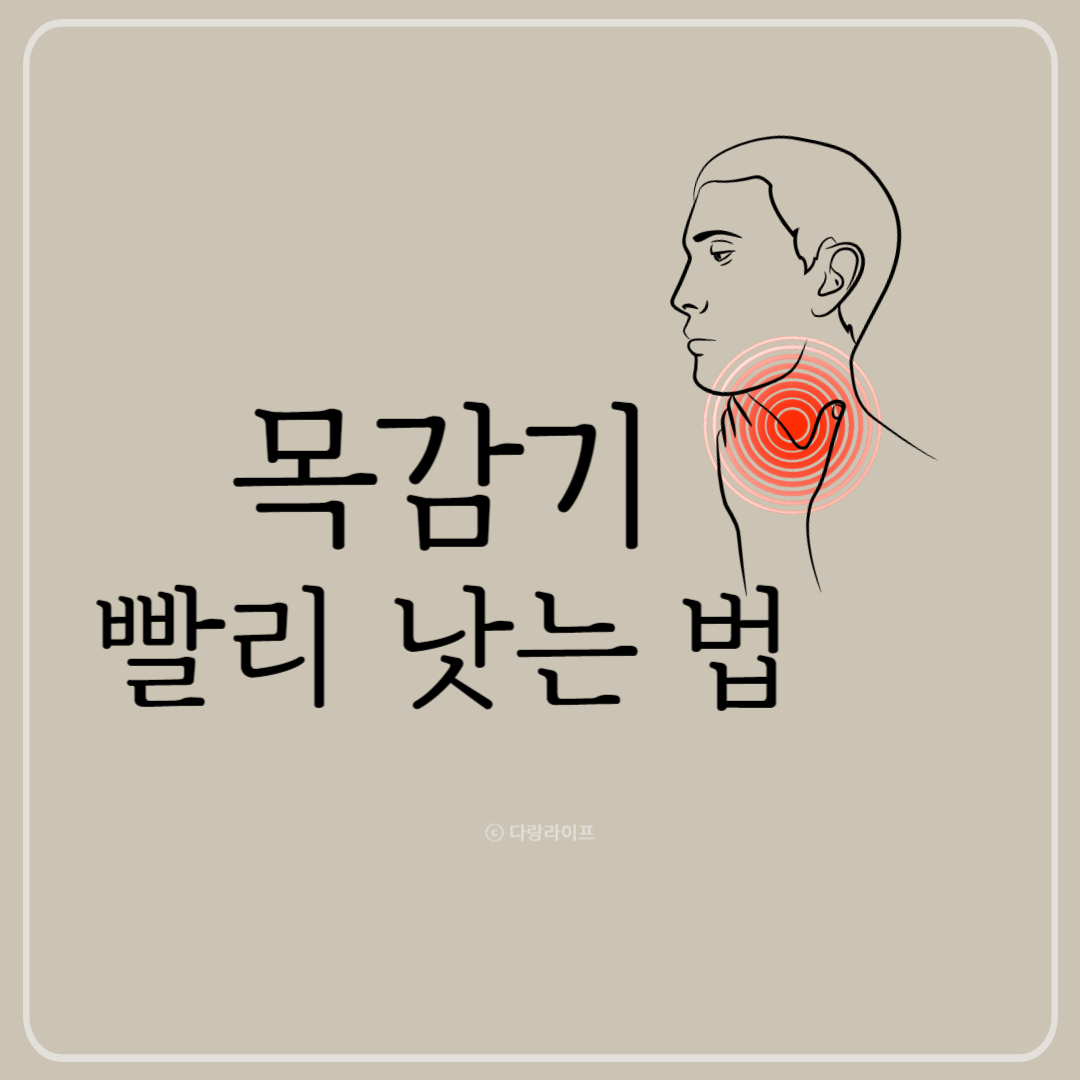 목감기의 원인과 목감기 빨리 낫는 법 5가지