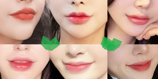 입술 회복