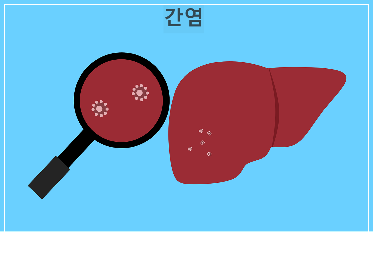 간염