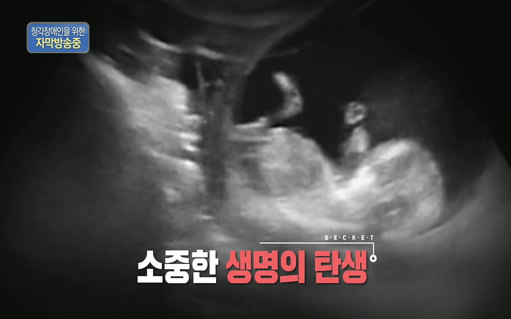 생로병사의 비밀.E836.220921p.H264-F1RST.mp4_20220925_183641.412.jpg