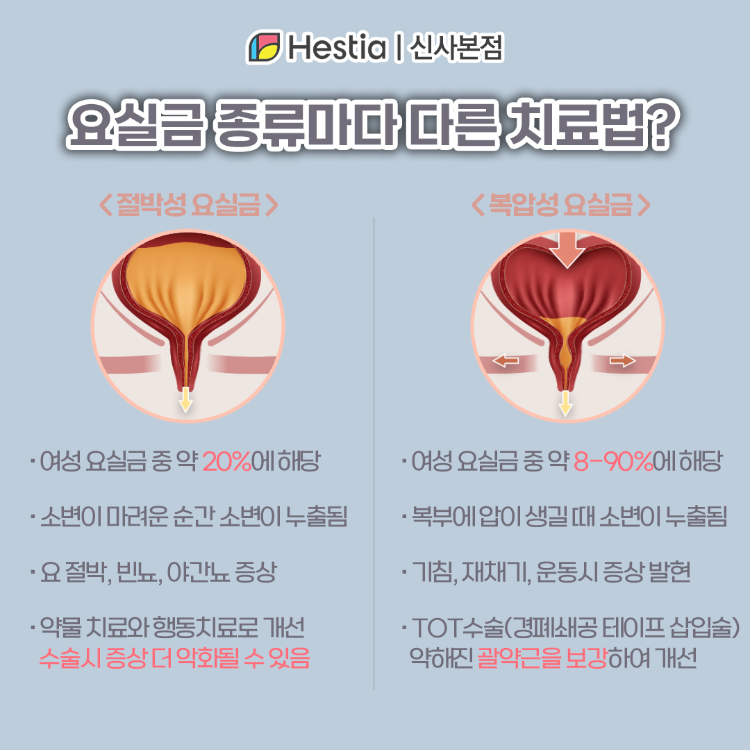 요실금재수술 갱년기 요실금 뛸때 소변 요실금마다 치료법이 다르다면..?