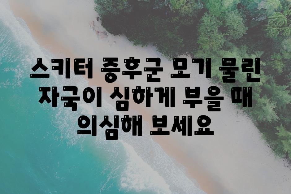 스키터 증후군 모기 물린 자국이 심하게 부을 때 의심해 보세요