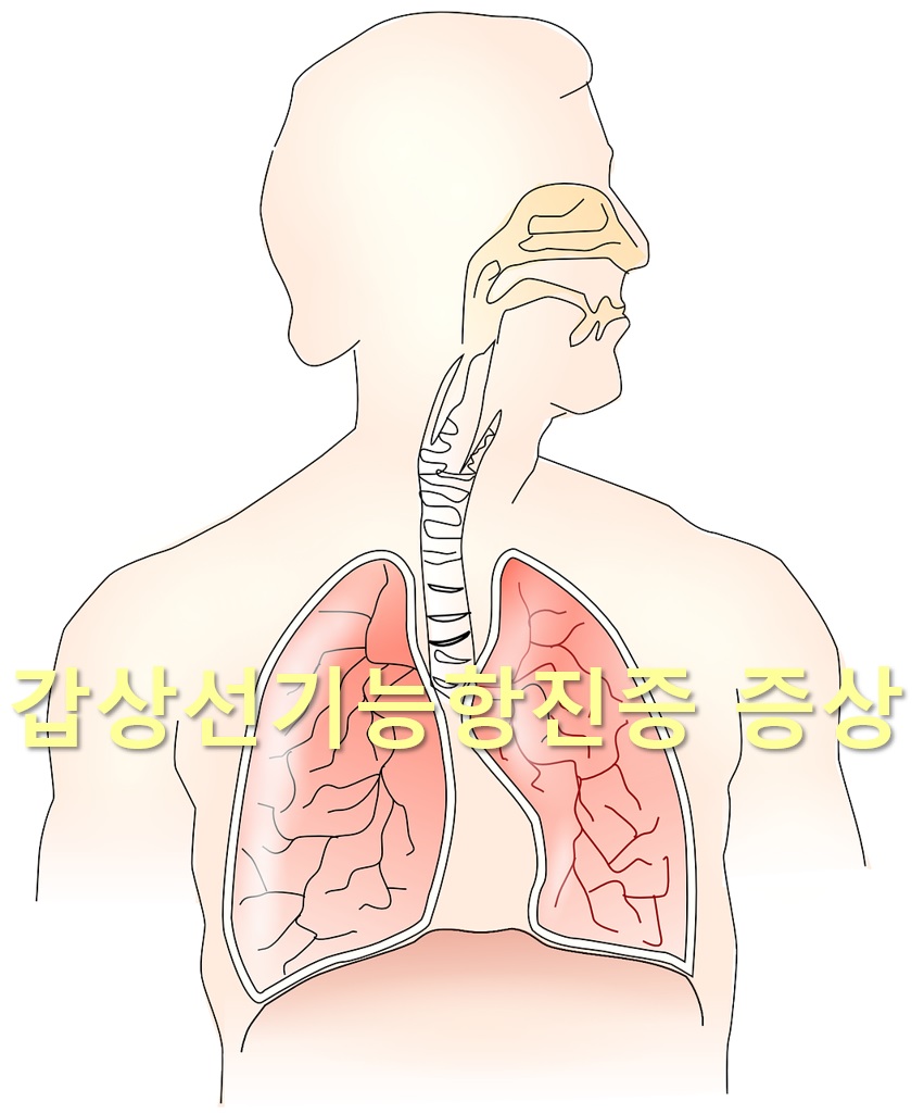  갑상선기능항진증 증상과 갑상선기능항진증 약 부작용
