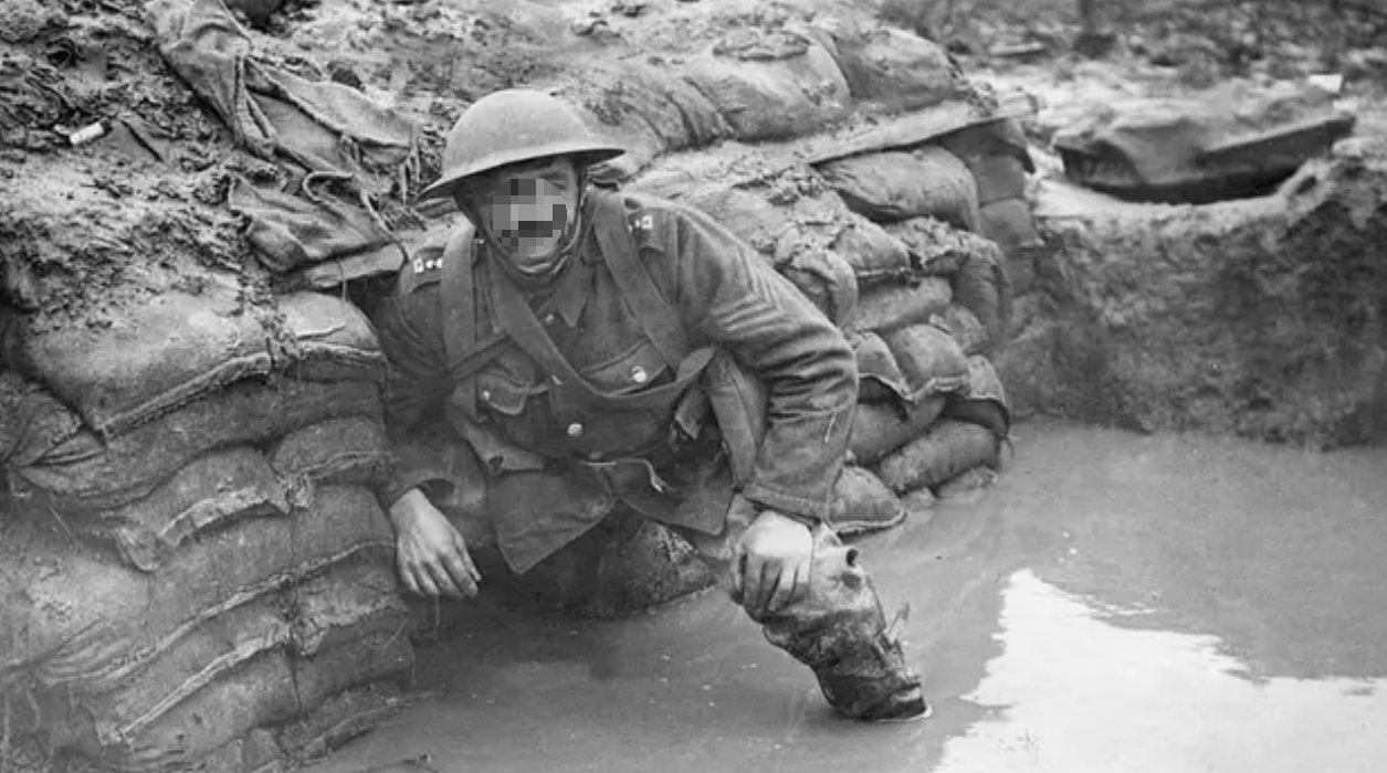 등드름 가드름 쉽게 없애는 법 7