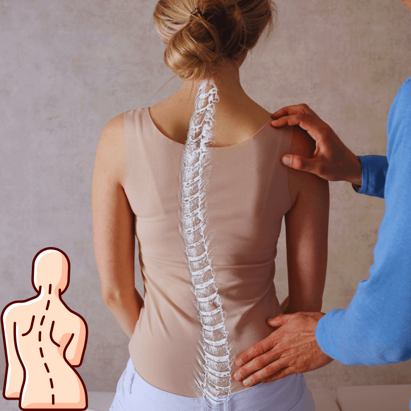 Scoliosis 척추-측만증
