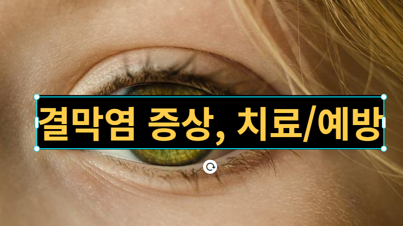  [건강정보] 봄철 결막염 증상, 원인, 예방 방법에 대해 알아봐요.