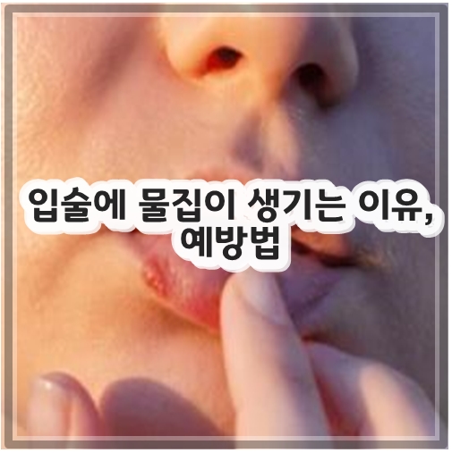 입술에 물집이 생기는 이유, 예방법