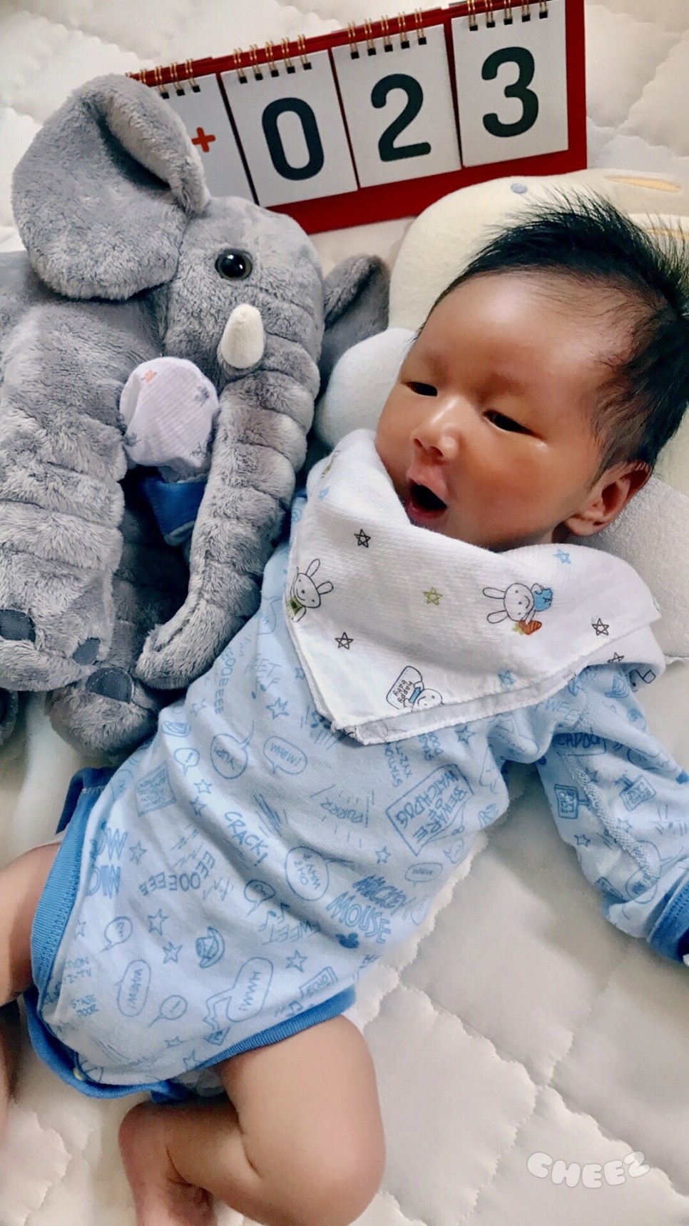 치료 너무 걱정하지 마세요 신생아 황달 원인과 수치, 20