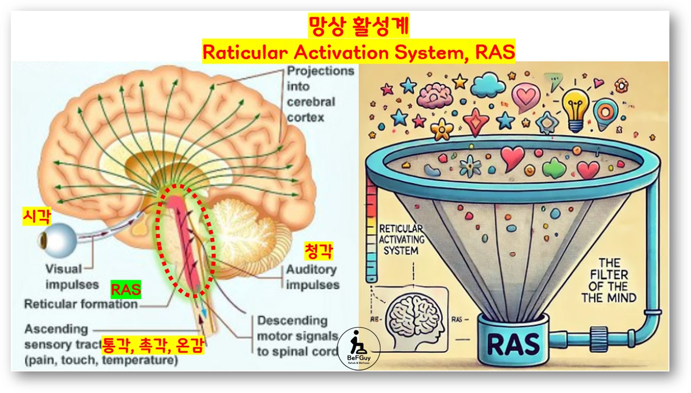 망상 활성계