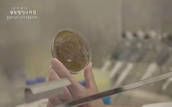[792회] 생로병사의 비밀 - KBS[세균의 습격, 당신의 잇몸을 지켜라!] 감기보다 병원을 더 자주 찾게 만드는 질병이 있다. 바로 치주질환이다. 2020년 외래 다빈도 질병 1위를 차지한 치은염 및 치주질환 환자는 1,637_20220505_141604.963.jpg