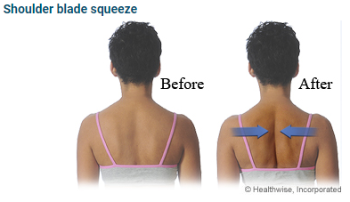 Scapular retraction