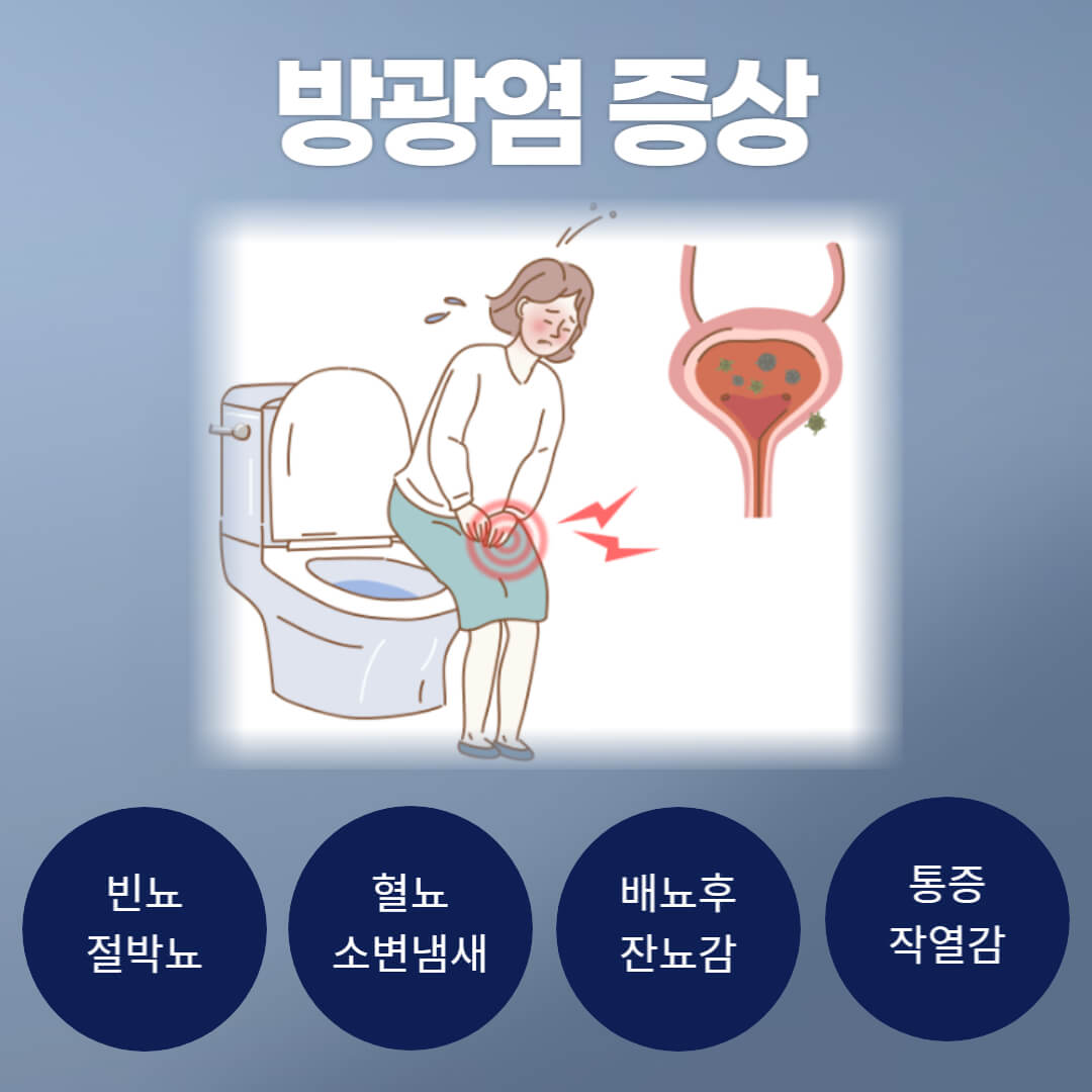 방광염 증상