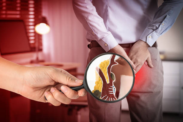 항문에서 피가나는 이유 자세히 10