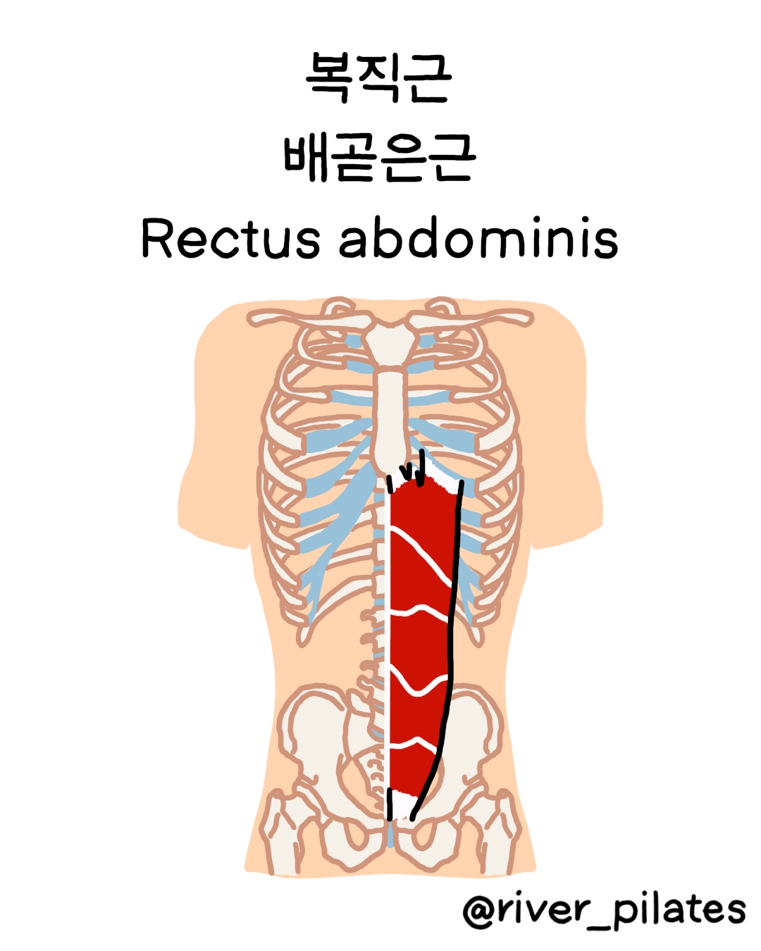 복직근