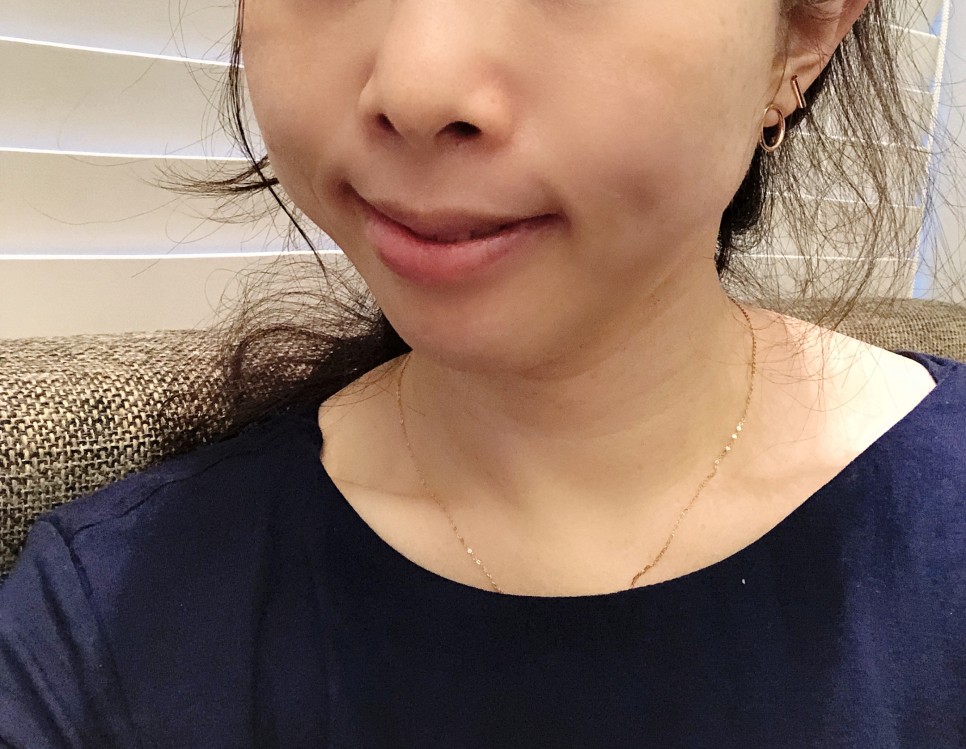 [강남/보스] 코볼 환원주사 - 리뷰 및 가격정보 10