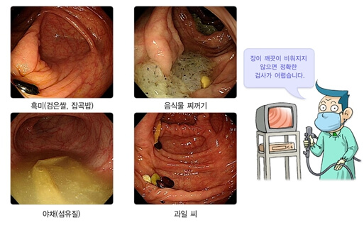 위&middot;대장내시경 동시 검사 후기: 통증&amp;#44; 준비&amp;#44; 결과까지 솔직하게
